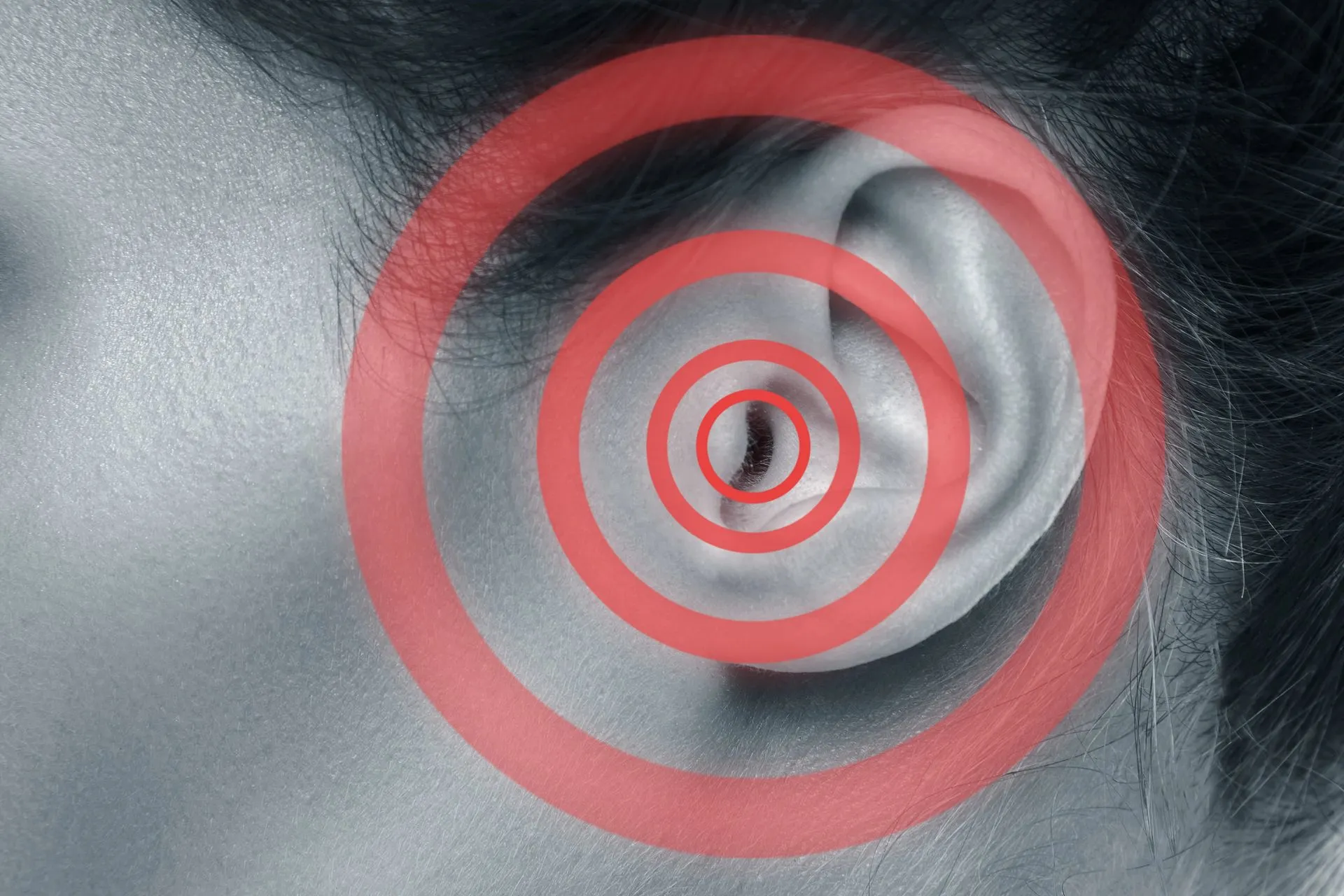 Oreille entourée de cercles évoquant un acouphène